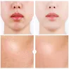Hyaluronic acid face serum - moisturizing - shrink pores - acne marks removal - nourishingSkin