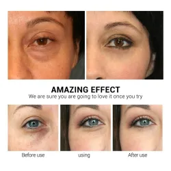 Eye mask - moisturizing gel patches - anti-wrinkle - firming - Vitamin C - 50 piecesSkin