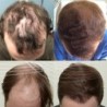 Hair growth essential oil - anti hair loss liquid - serumHair