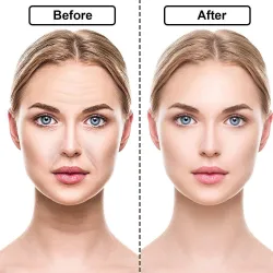 Silicone anti-wrinkle sticker - reusable - 16 piecesSkin