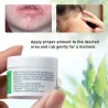Green skin care cream - herbal ointment - headache - sunburn - muscle aches - pain relief - 10 gSkin