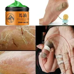 Horse oil ointment - hand / foot repair cream - moisturizerSkin