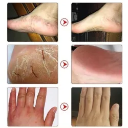 Horse oil ointment - hand / foot repair cream - moisturizerSkin