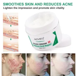 Scar removal cream - stretch marks - acne marks - face / body treatment - 50 mlSkin