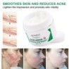Scar removal cream - stretch marks - acne marks - face / body treatment - 50 mlSkin