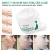 Scar removal cream - stretch marks - acne marks - face / body treatment - 50 mlSkin