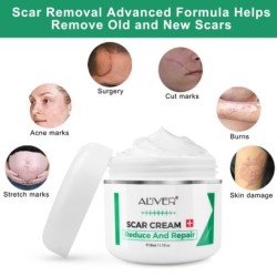 Scar removal cream - stretch marks - acne marks - face / body treatment - 50 mlSkin