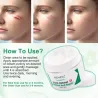 Scar removal cream - stretch marks - acne marks - face / body treatment - 50 mlSkin