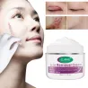Scar removal cream - stretch marks - acne marks - face / body treatment - 50 mlSkin