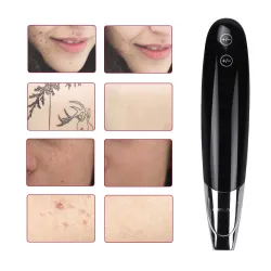 Laser pen - mole / freckles / tattoo / dark spots / acne removalSkin