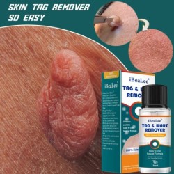 Skin tag / wart remover - serum - 20 mlSkin