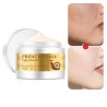 Snail face cream - hyaluronic acid - moisturizer - anti wrinkle - day serumSkin