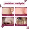 Face serum - fruit acid essence - AHA - BHA - acne treatment - whitening - 30mlSkin