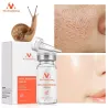 Snail extract face serum - moisturizing / whitening / anti wrinkle / anti acneSkin