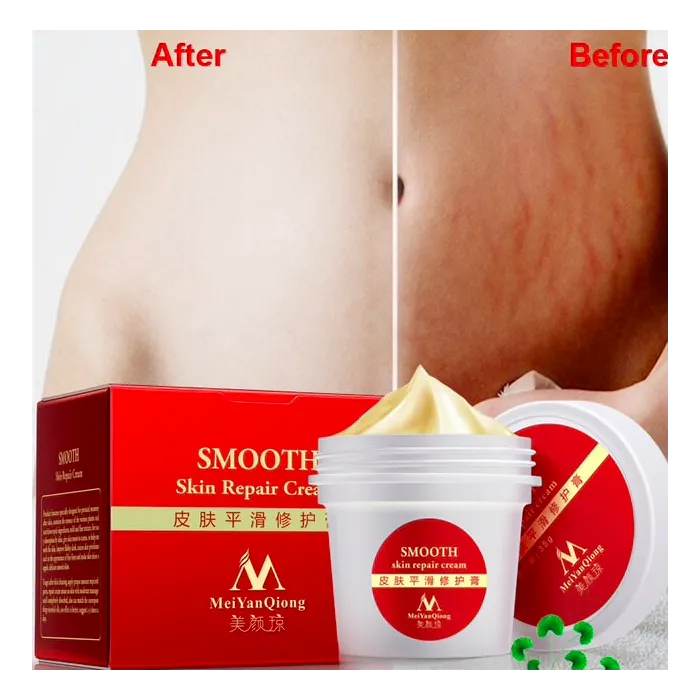 Stretch marks & scars removal repair body creamMassage