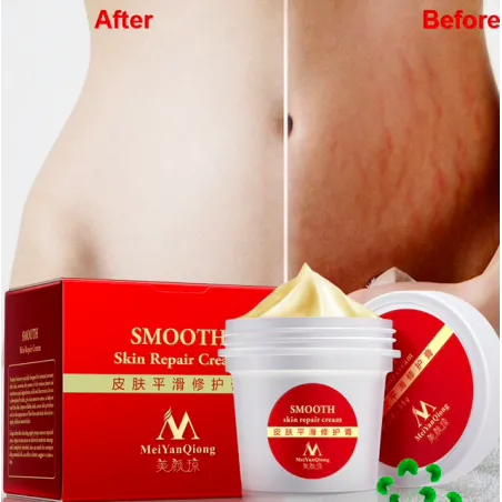 Stretch marks & scars removal repair body creamMassage