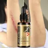 Lavender massage oil - scar removal - anti acne - hyaluronic acid serumMassage