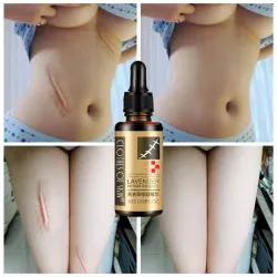 Lavender massage oil - scar removal - anti acne - hyaluronic acid serumMassage